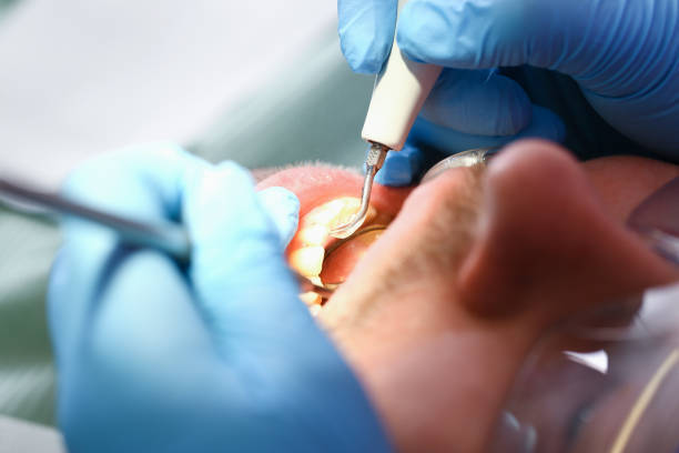 Best Knocked-Out Tooth Emergency  in Franklin, NJ